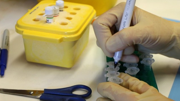 Team israeliano scopre due proteine fondamentali nella lotta al cancro