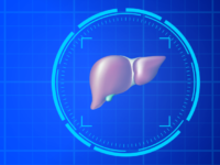 Chirurgia innovativa per congelare le metastasi del cancro al fegato