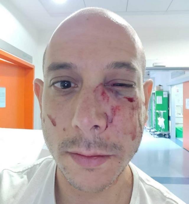 Antisemitismo a Pisa, turista picchiato perché israeliano